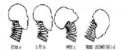 头枕怎么上下调节（头枕的正确使用方法图解）